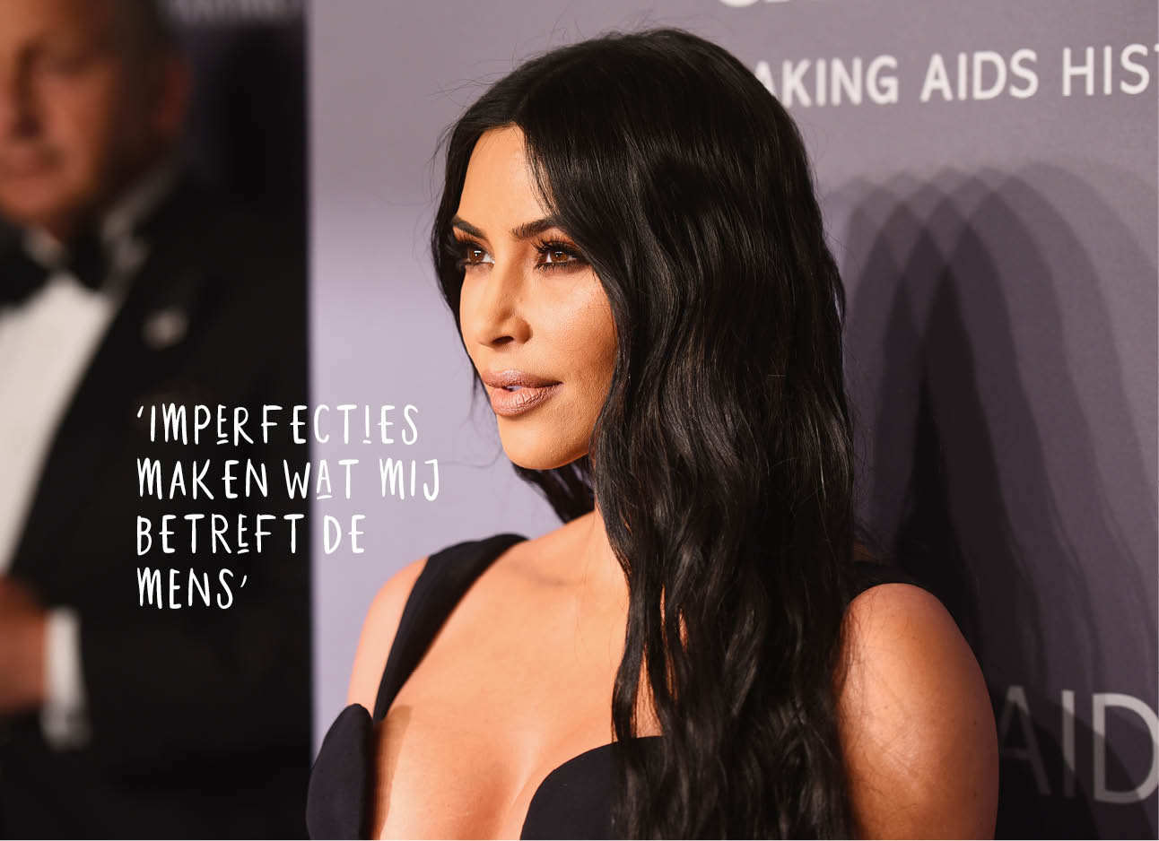 Even over Kim Kardashian en psoriasis