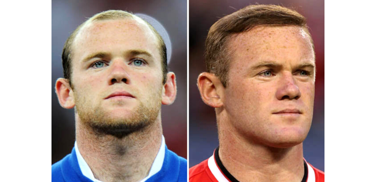 Rooney, Now and then